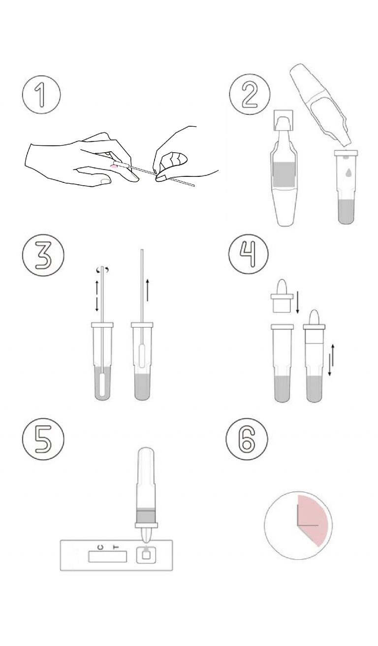 Monkeypox Rapid Test Kit JOYSBIO Biotechnology
