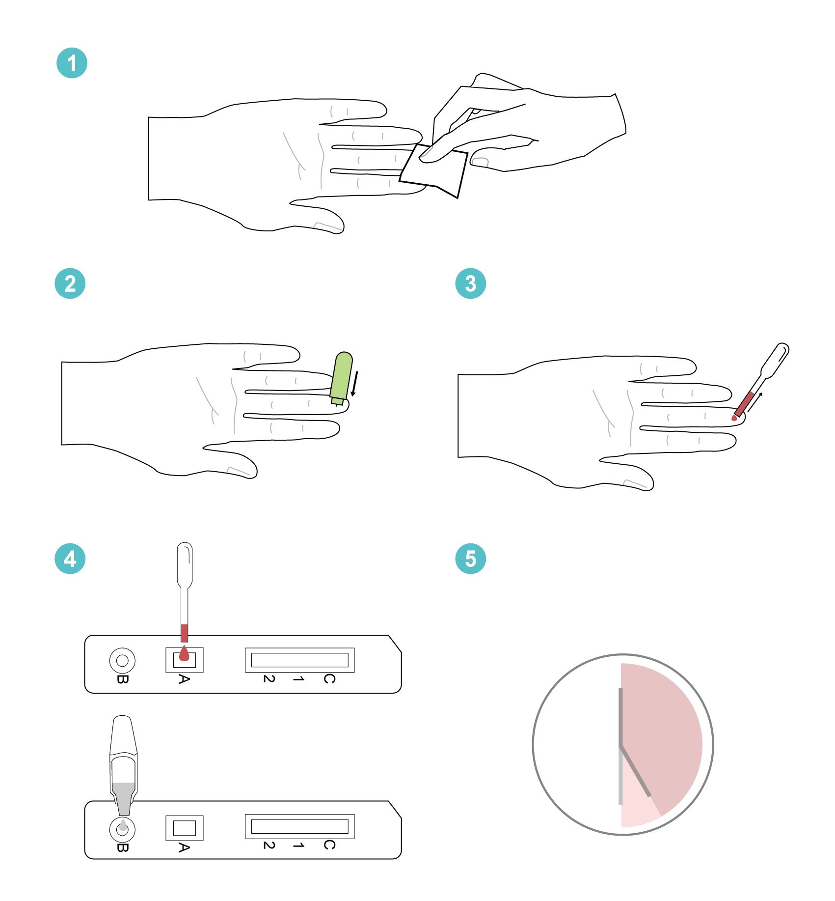 JOYSBIO Monkeypox IgM IgG Antibody Rapid Test Kit Operation Procedure