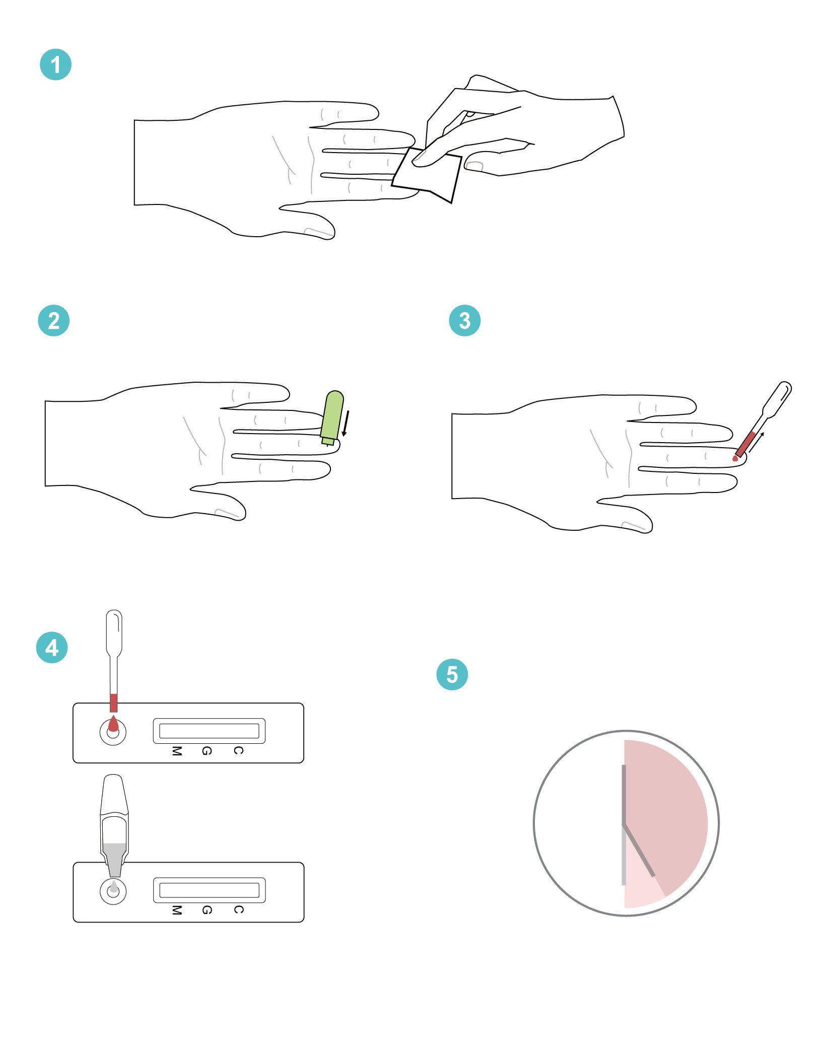 Monkeypox Rapid Test Kit - JOYSBIO Biotechnology